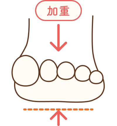 横アーチなし 衝撃が身体に伝わる